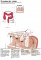 /album/fotogaleria/cancer-colorrecal-jpg/